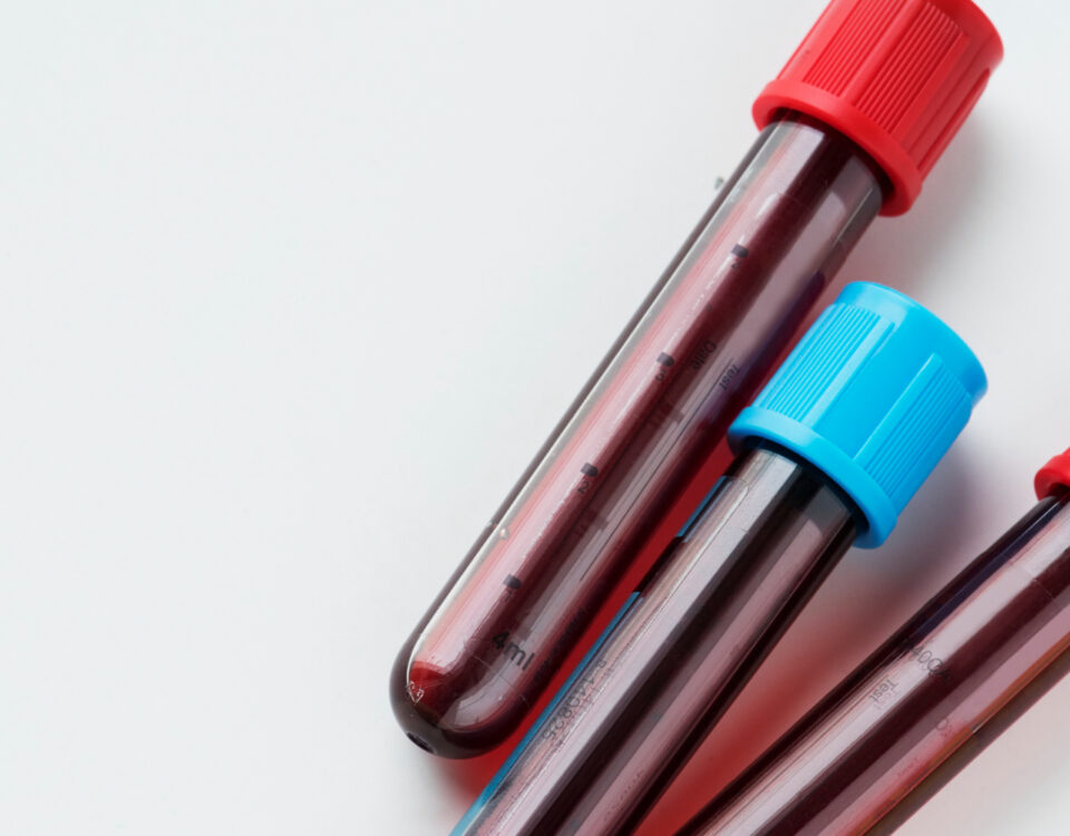 A amostra pode mudar antes de chegar ao laboratório?